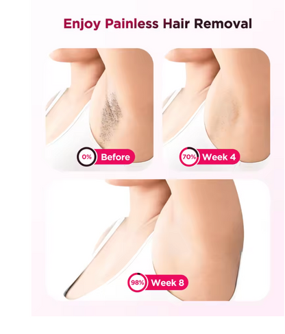 IPL Laser Hair Removal Device – Safe, Painless, and Long-Lasting Hair Reduction